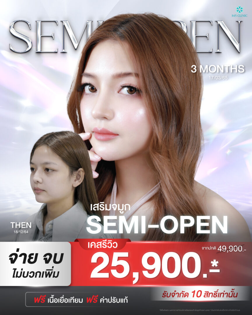 โปรโมชั่น เสริมจมูก semi open S45 Clinic