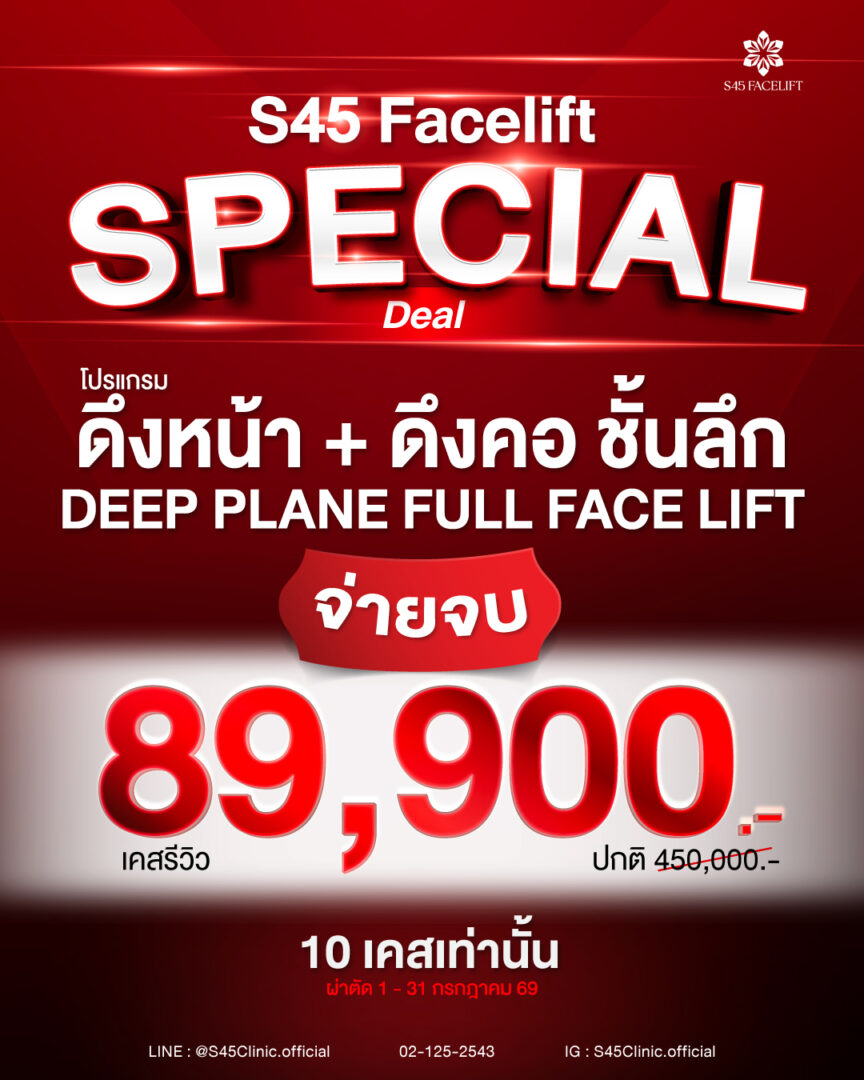 โปรโมชั่นดึงหน้า