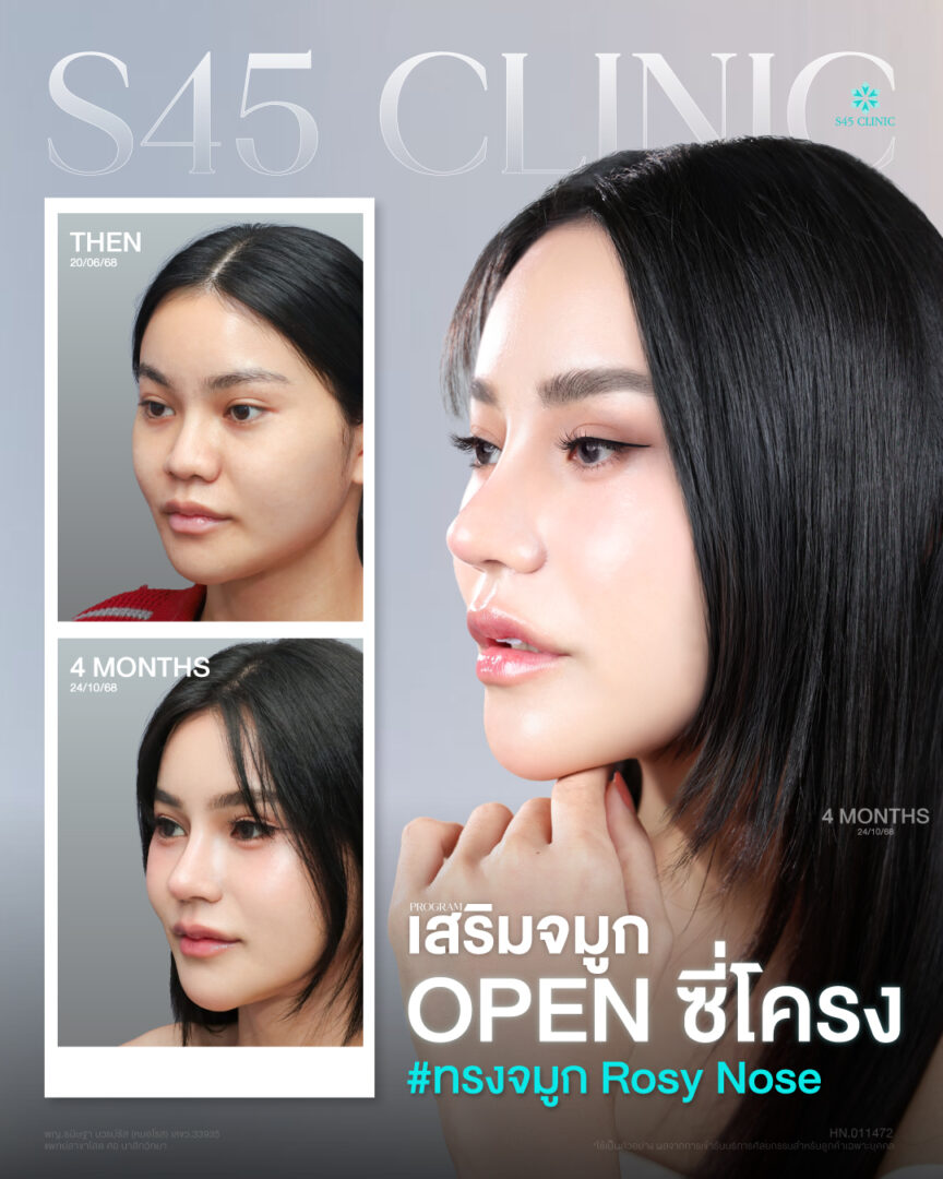 31 07 2026 Open เนย์ หมอโรส