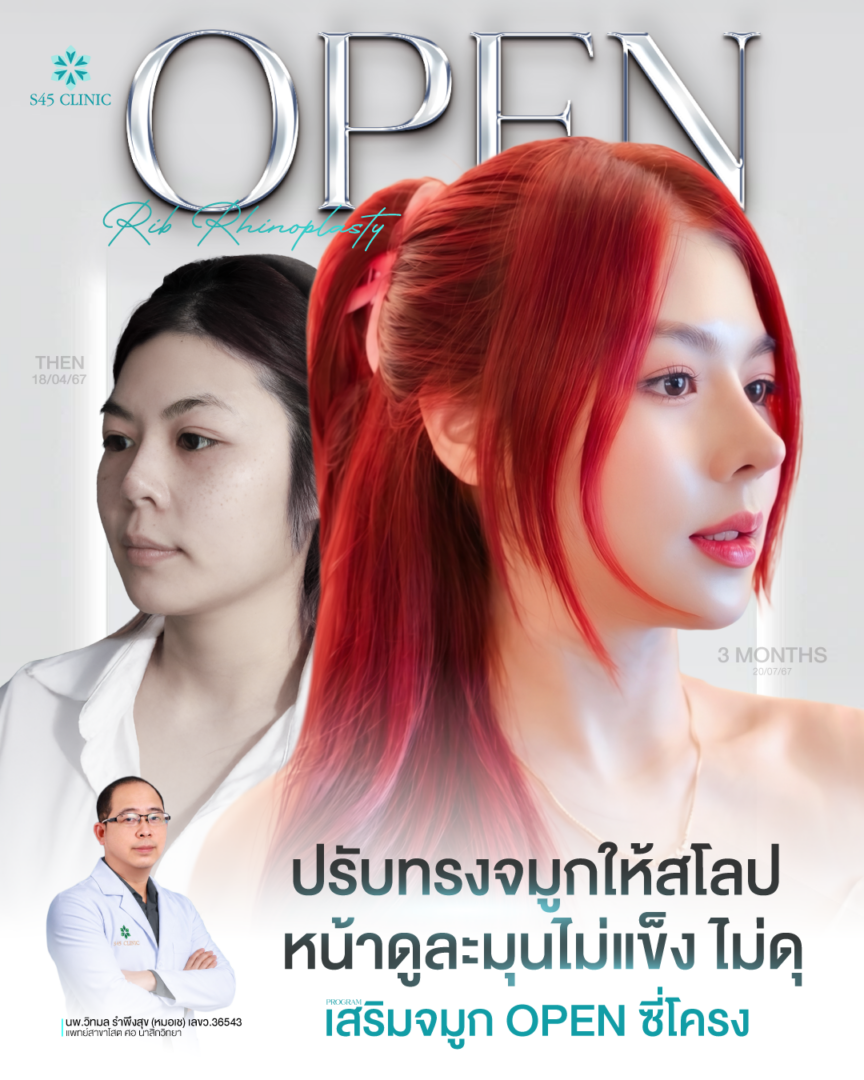FB IG หมอเชสาวผมแดง