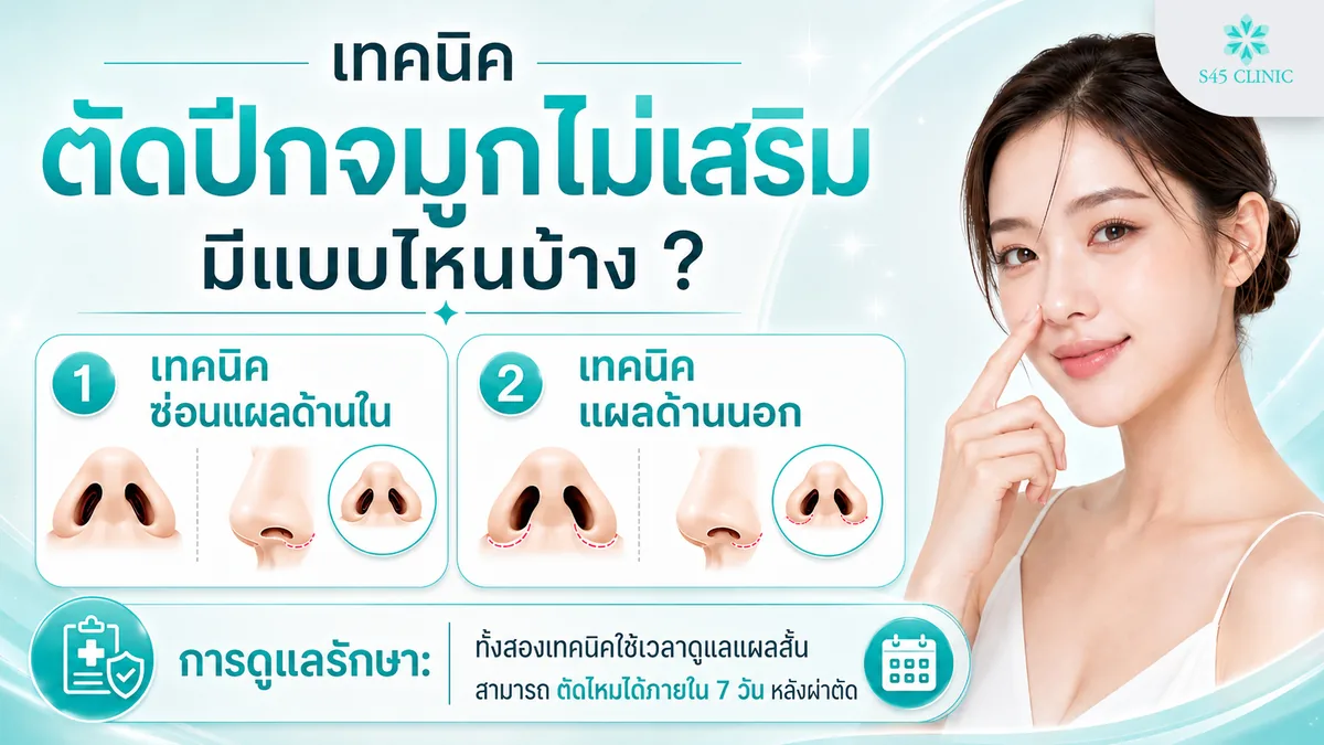 เทคนิคตัดปีกจมูกไม่เสริม แบบซ่อนแผลด้านในและแผลด้านนอก