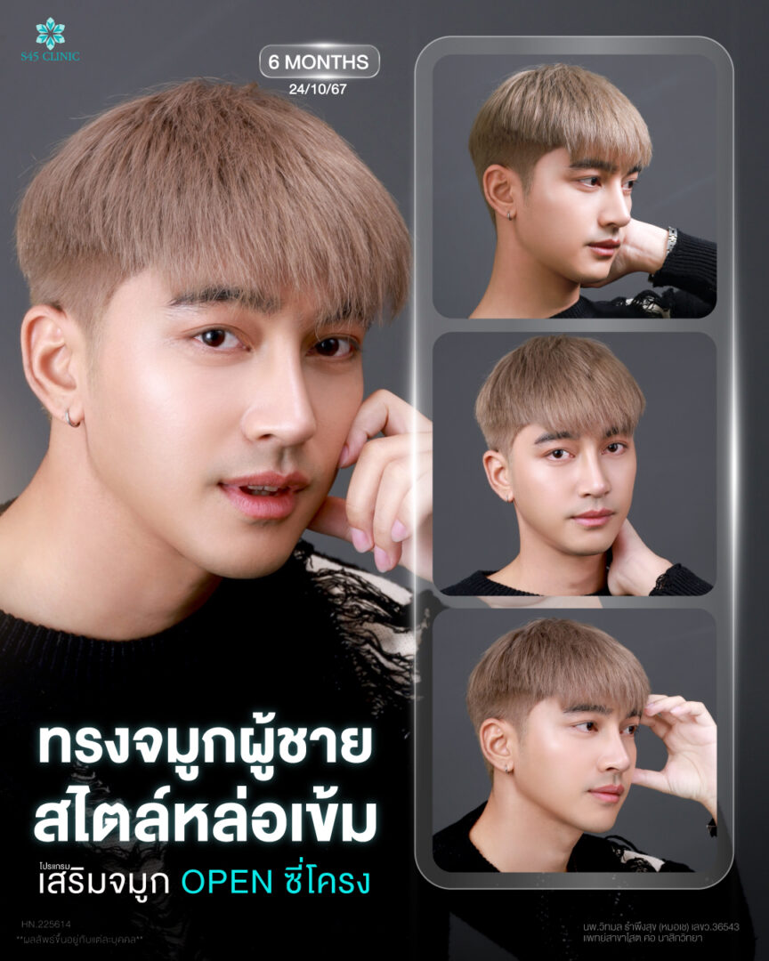 banner เสริมจมูก open ครูเบ็น หมอเช 01