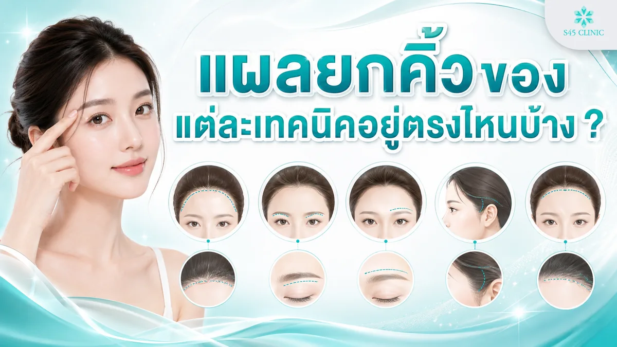แผลยกคิ้ว ซ่อนอยู่ที่ไหน เห็นชัดไหม วิธีดูแลแผลหลังทำให้สมานตัวดี