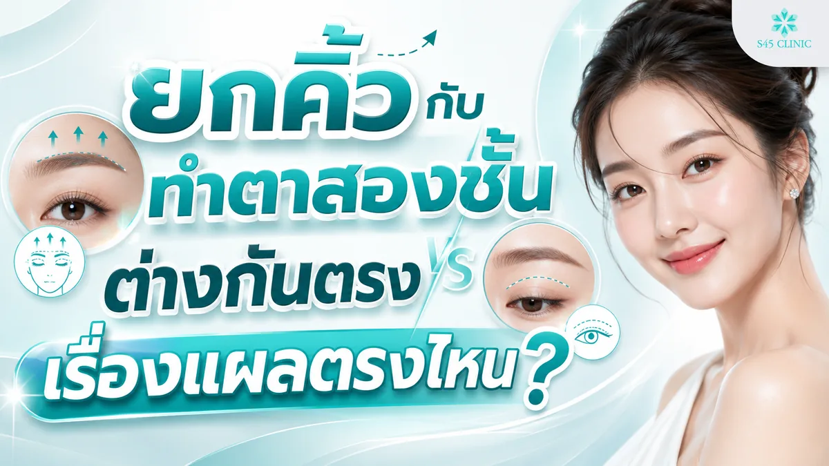 แผลยกคิ้วของแต่ละเทคนิคอยู่ตรงไหน