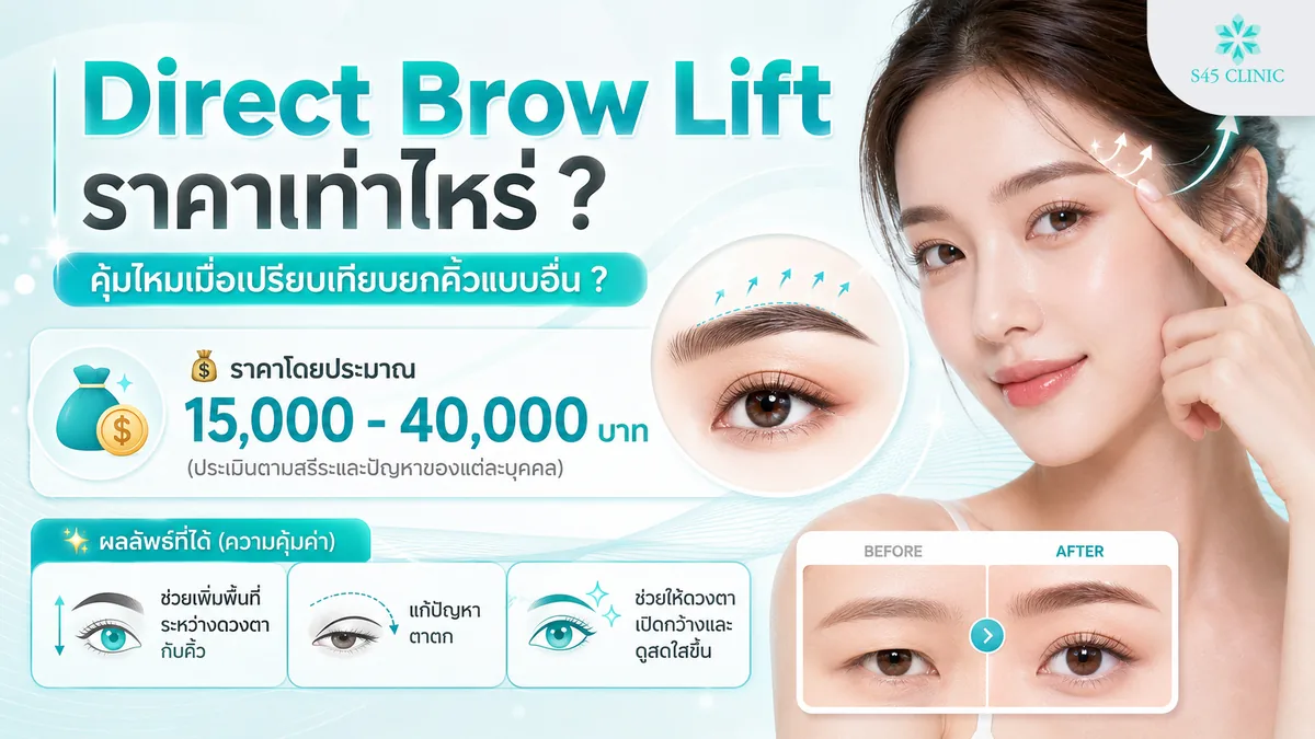 Direct Brow Lift ราคาเท่าไหร่ ต่างจากเทคนิคอื่นอย่างไร