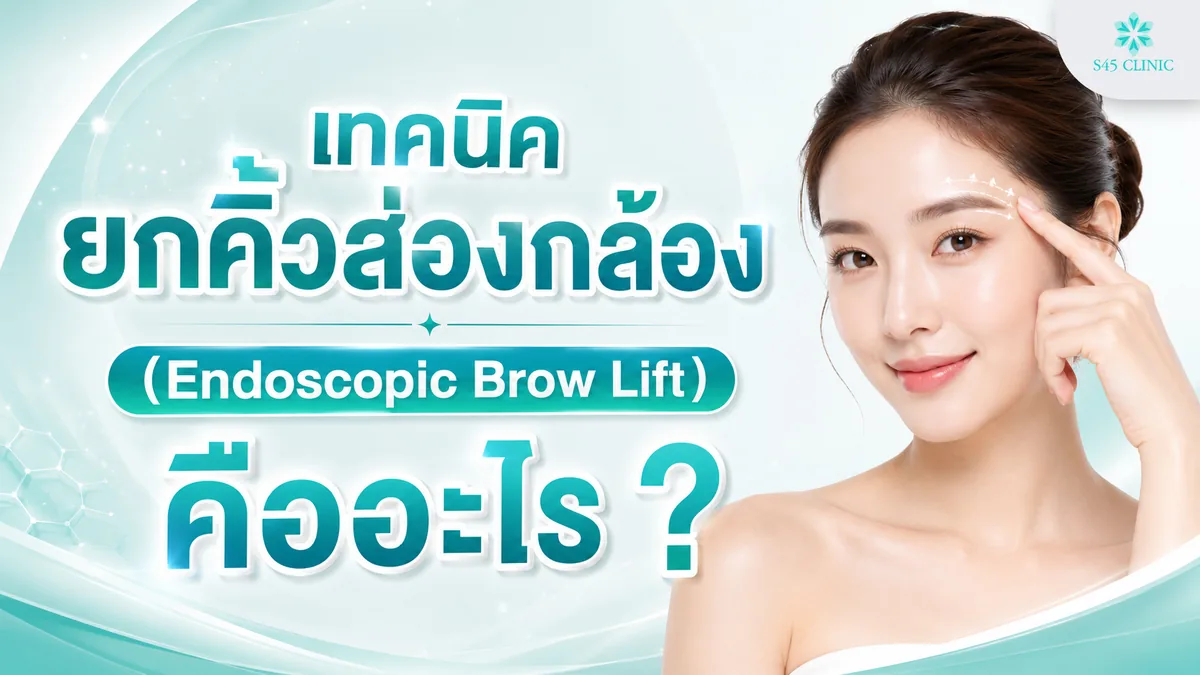 เทคนิคยกคิ้วส่องกล้อง Endoscopic Brow Lift
