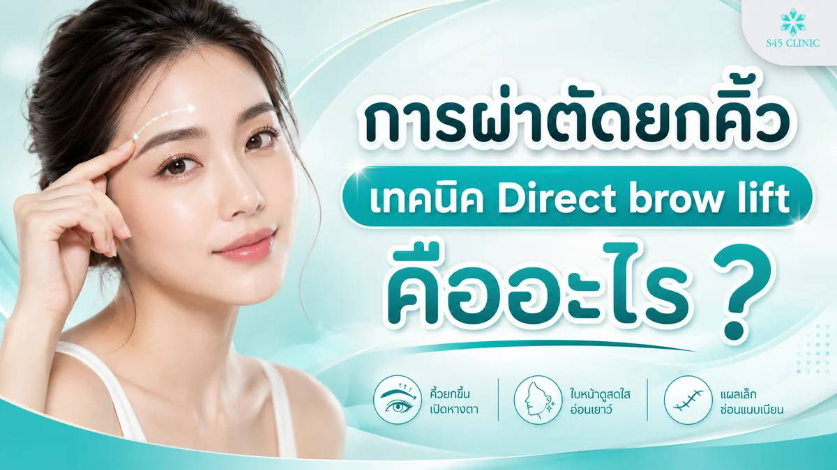 การผ่าตัดยกคิ้วเทคนิค Direct brow lift คืออะไร