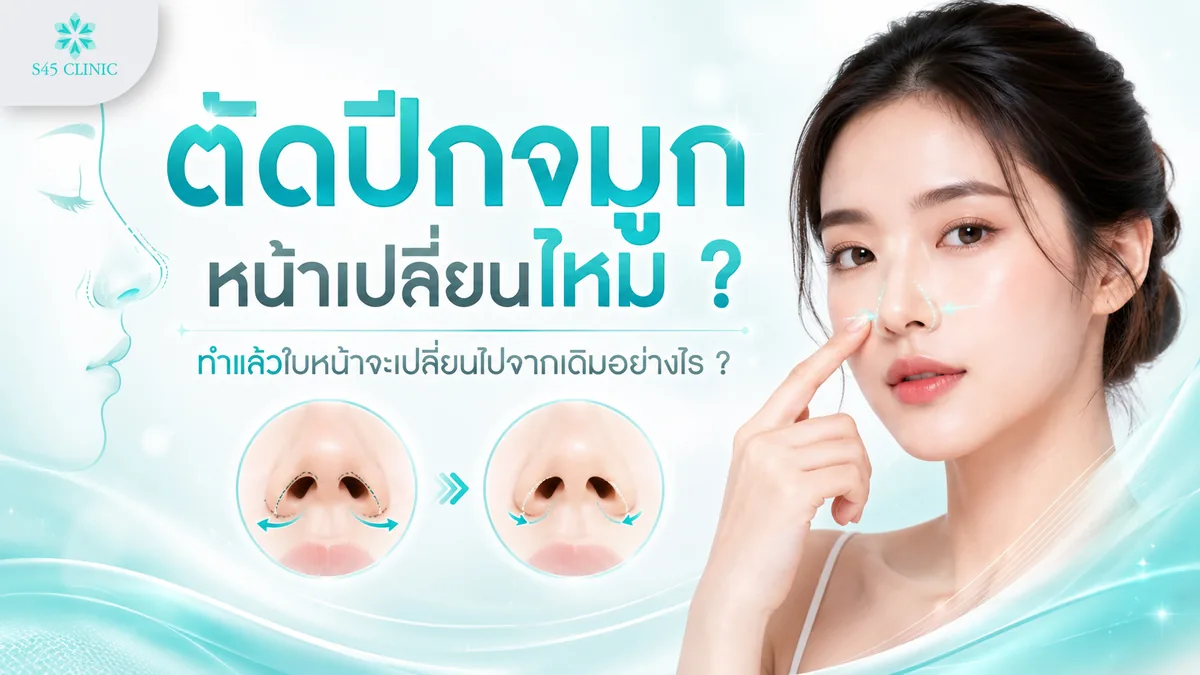 การตัดปีกจมูกหน้า ช่วยปรับให้ใบหน้าเปลี่ยนไปในทิศทางที่สมส่วนขึ้น