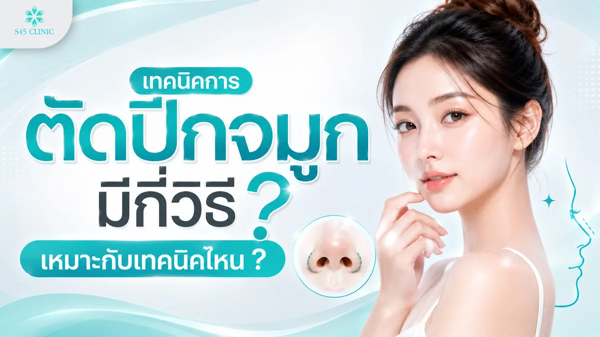 เทคนิคการตัดปีกจมูก