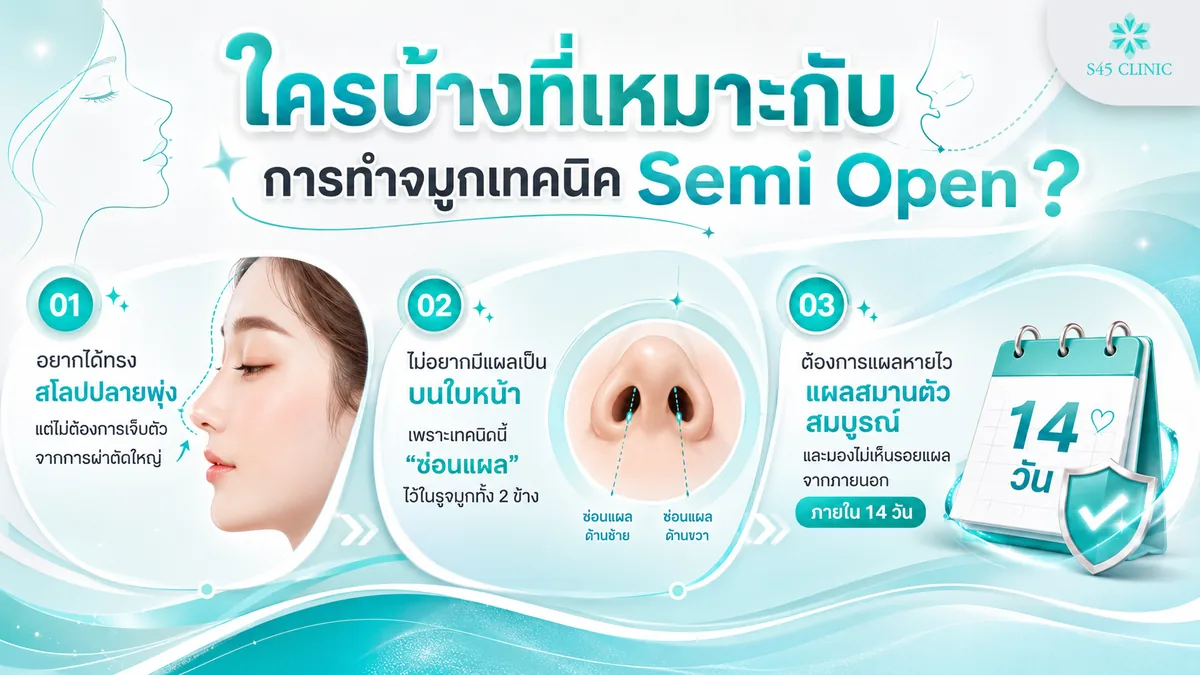 ลักษณะโครงสร้างจมูกเดิมที่เหมาะกับเทคนิค Semi Open