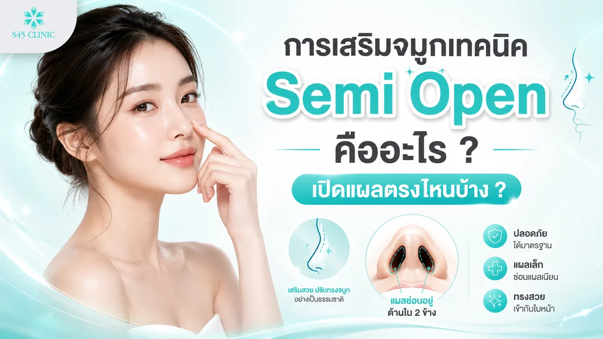 เสริมจมูกเทคนิค Semi Open คืออะไร เปิดแผลตรงไหน
