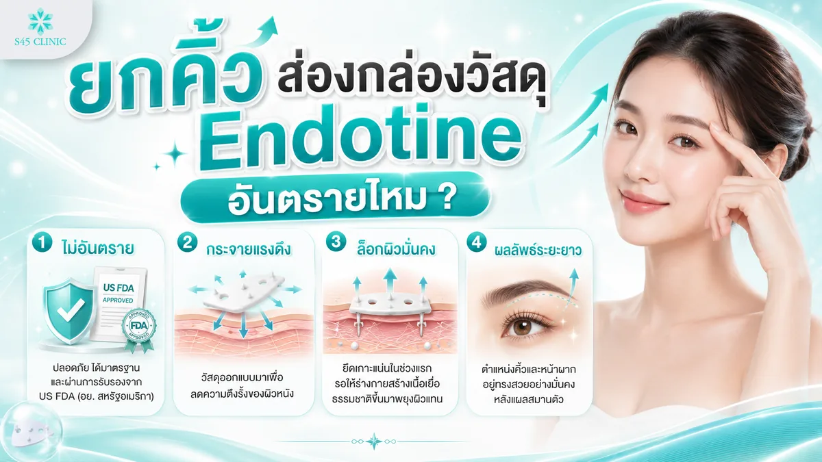 ยกคิ้วด้วยวัสดุ Endotine วิธีที่ได้มาตรฐาน