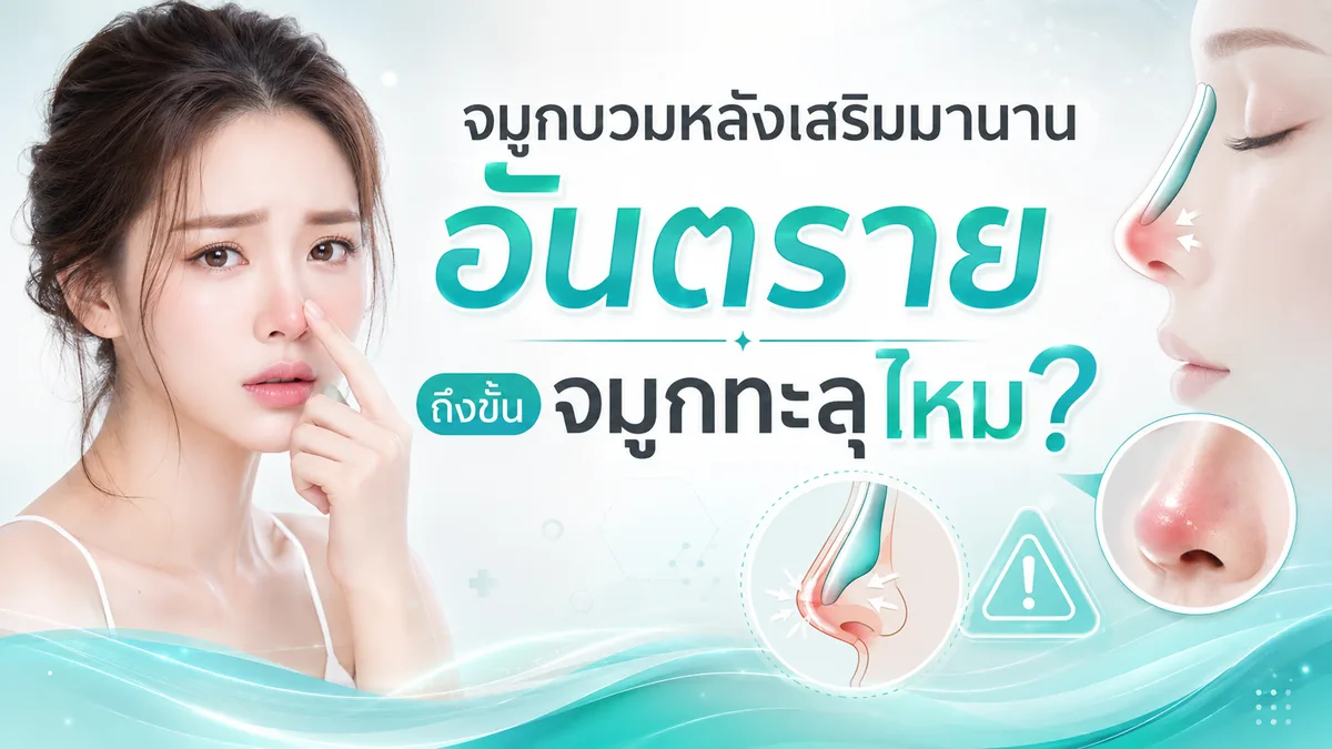 จมูกบวมหลังเสริมมานาน อาจนำไปสู่จมูกทะลุ
