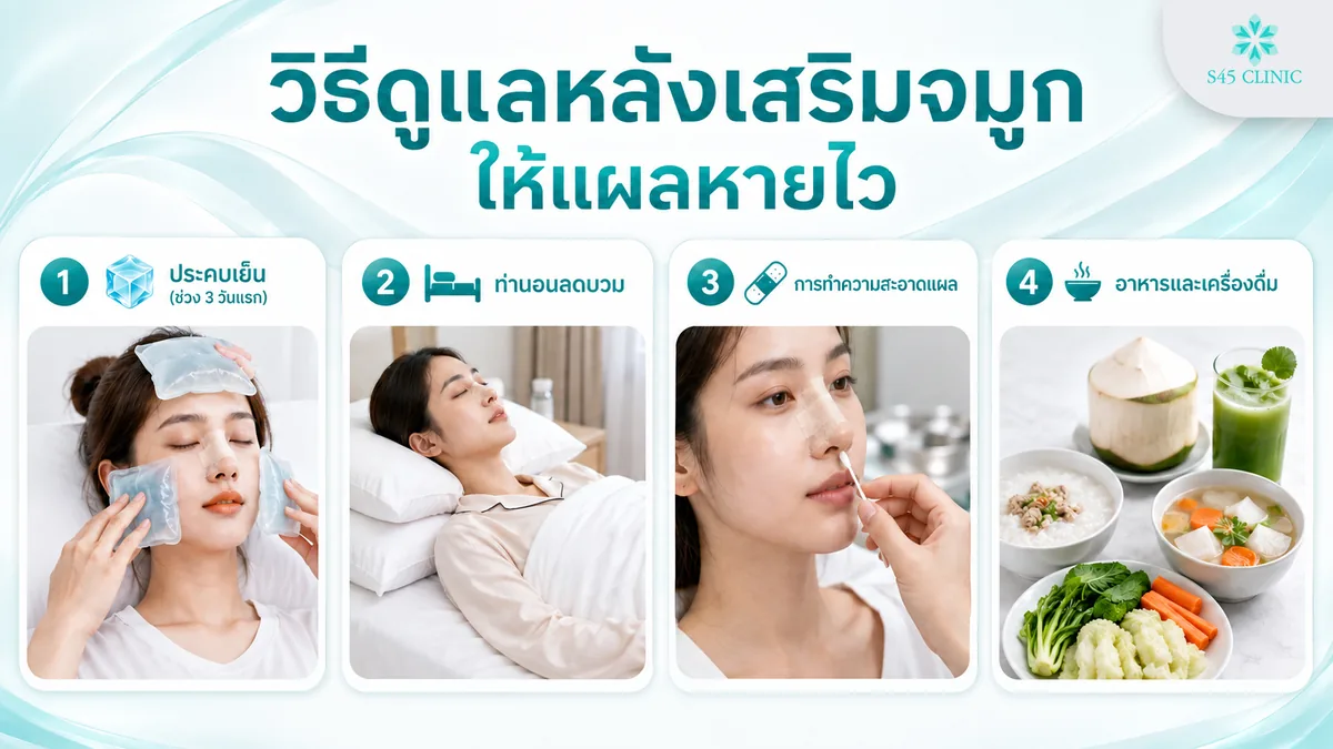 วิธีดูแลหลังเสริมจมูก ให้แผลหายไว