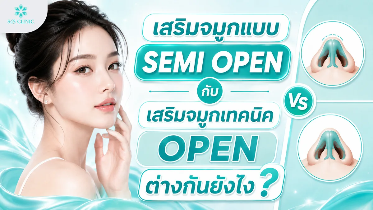 เสริมจมูกแบบ SEMI OPEN กับ เสริมจมูกเทคนิค OPEN ต่างกันยังไง