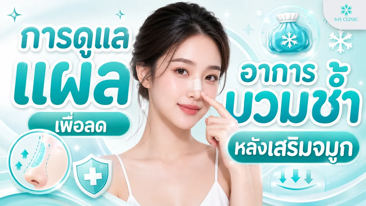การดูแลแผลเพื่อลดอาการบวมช้ำหลังเสริมจมูก