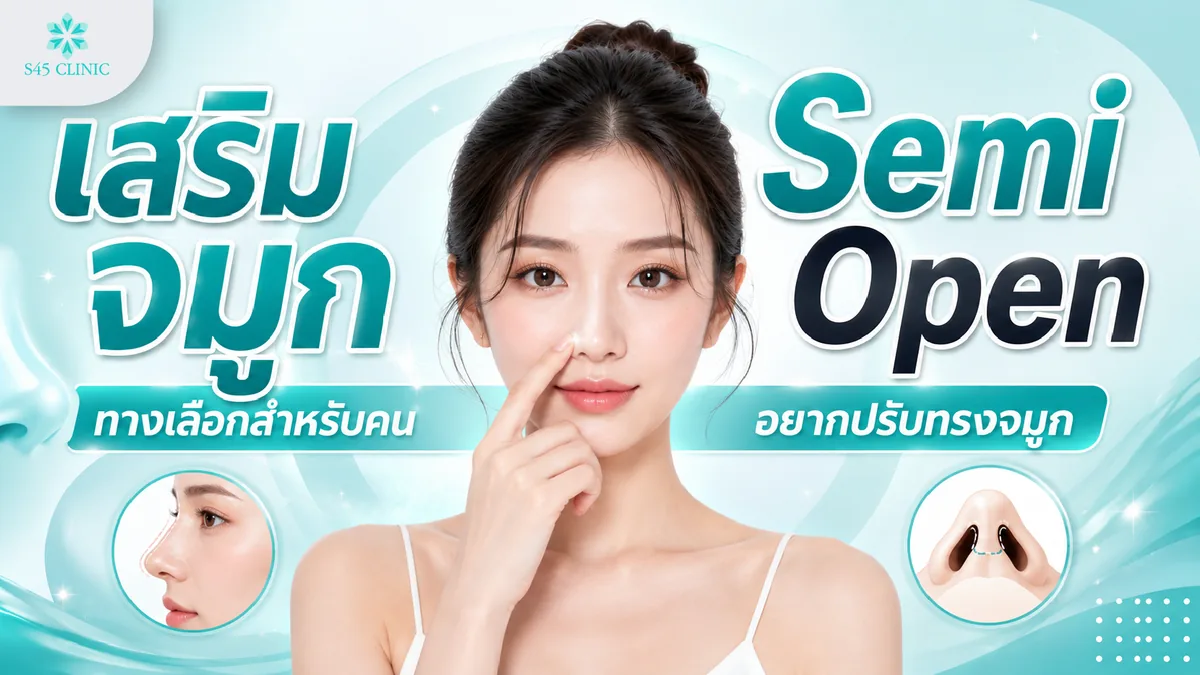 เสริมจมูก Semi Open คืออะไร เหมาะกับการทำทรงจมูกแบบไหน
