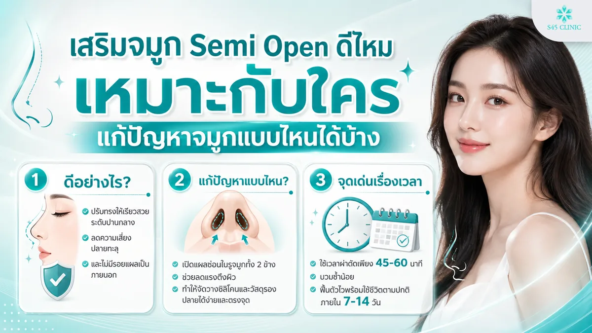 เสริมจมูก Semi Open ดีไหม เหมาะกับใคร สรุปข้อดีข้อเสีย