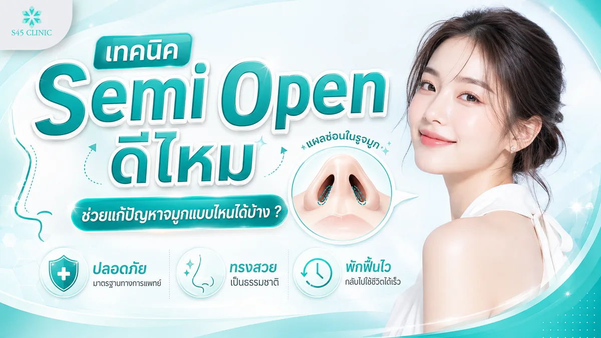 การเสริมจมูก Semi Open ช่วยแก้ปัญหาจมูกแบบไหน