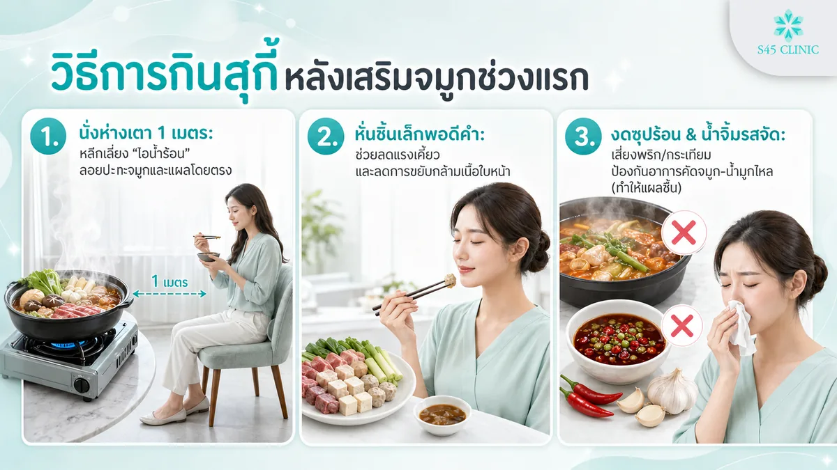 วิธีการกินสุกี้หลังเสริมจมูก