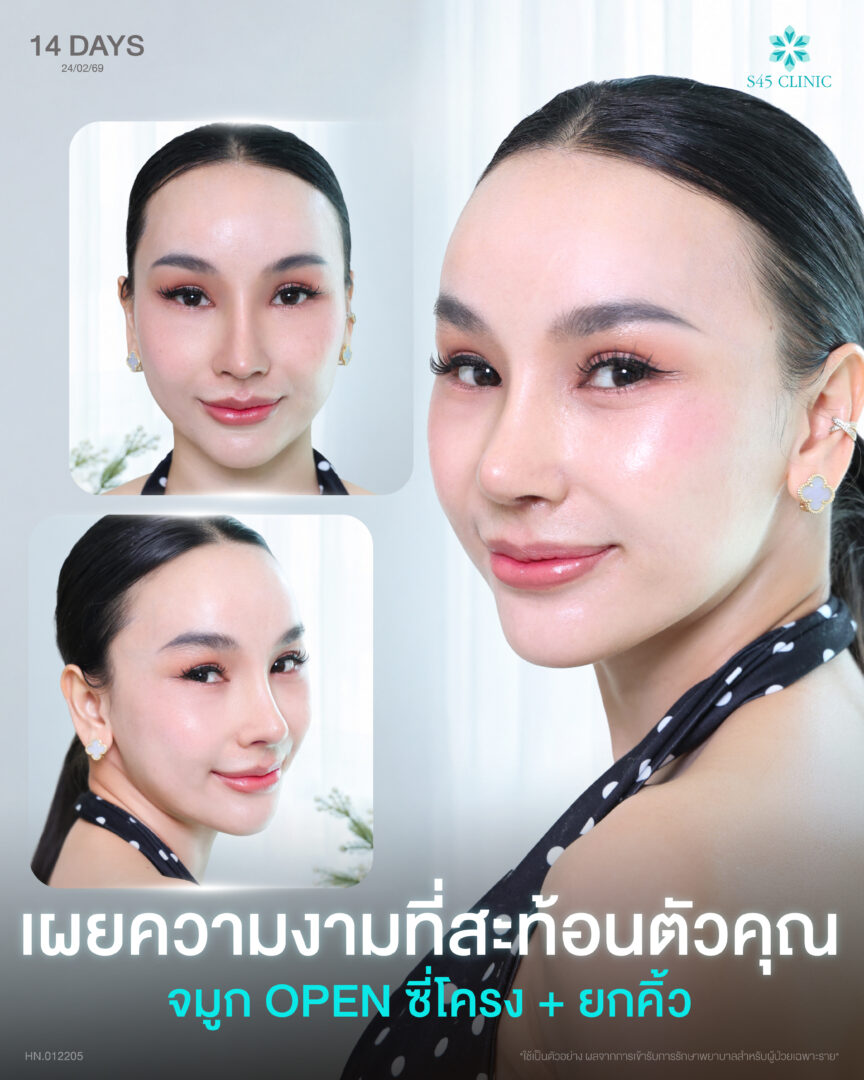 ฝน ศิริพร