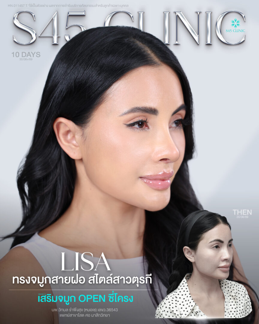ลิซ่า