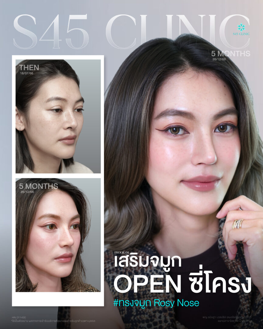 ศรสววรค์