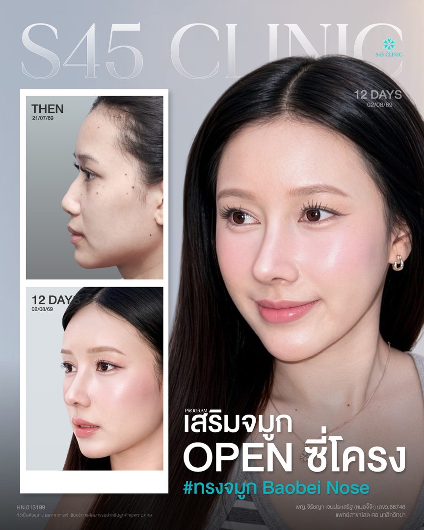 หมอจิ๊จ๊ะ กุ๊กกิ๊ก 3 ช่อง BA FB IG3