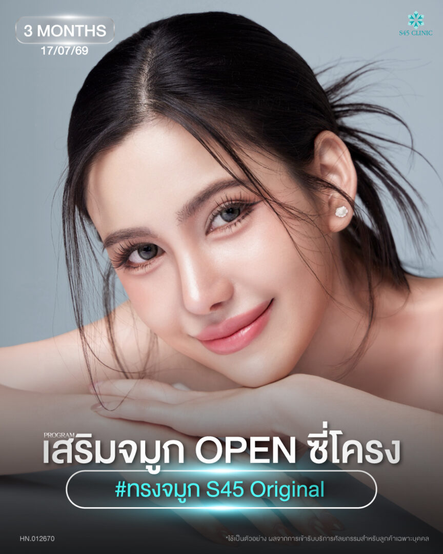 หมอตี้ แคนดี เทมสวย FB IG (1)