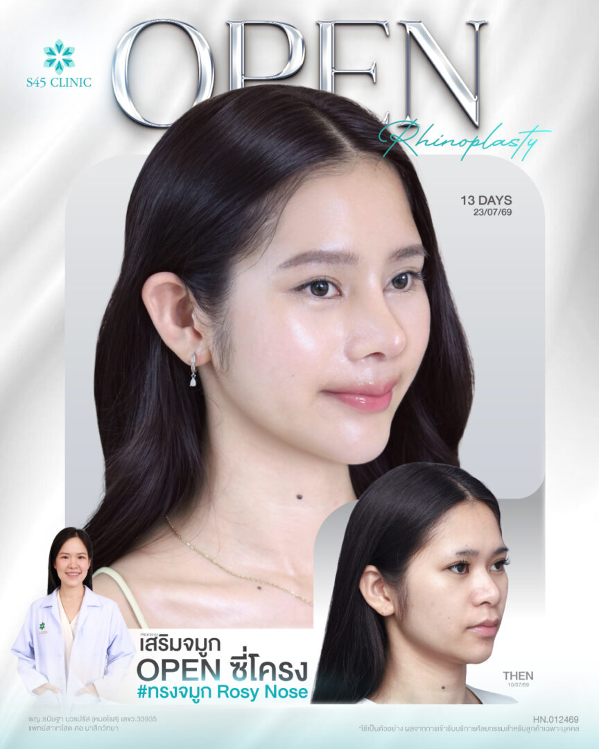 หมอโรส ชลลดา แสงเงิน FB IG