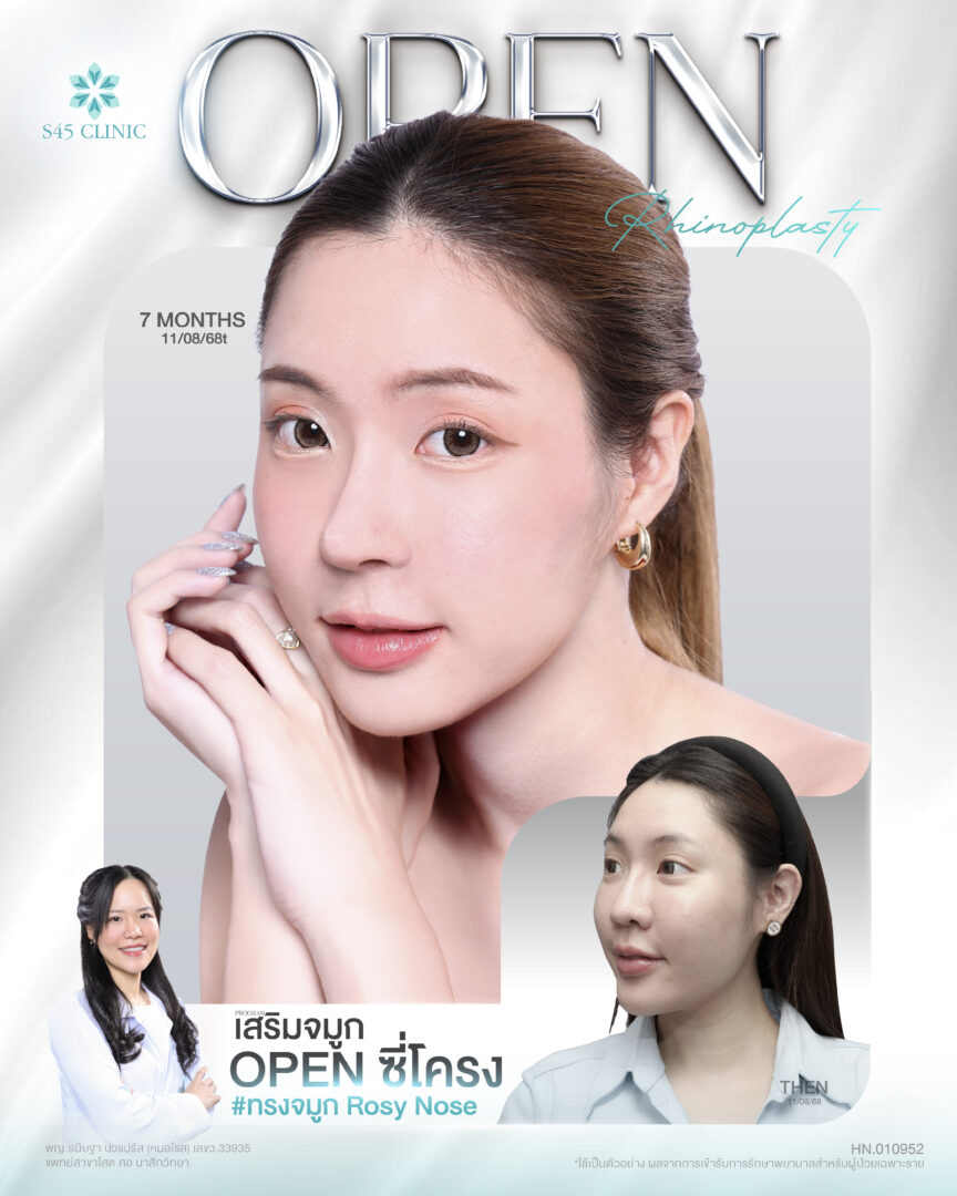 หมอโรส อิมธรรมธร