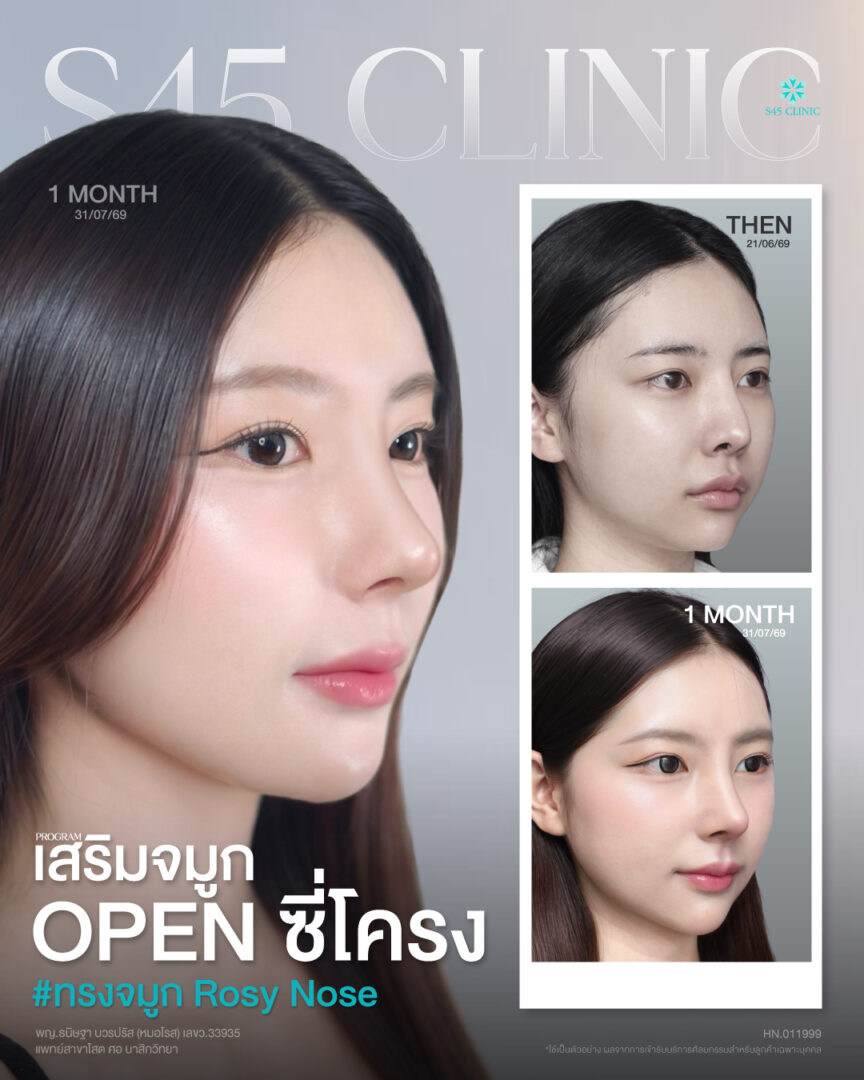 หมอโรส โฟม 3 ช่อง
