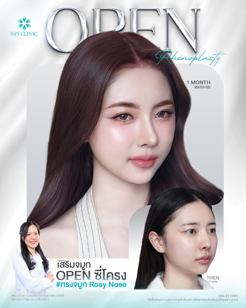 หมอโรส โฟม สวย FB IG