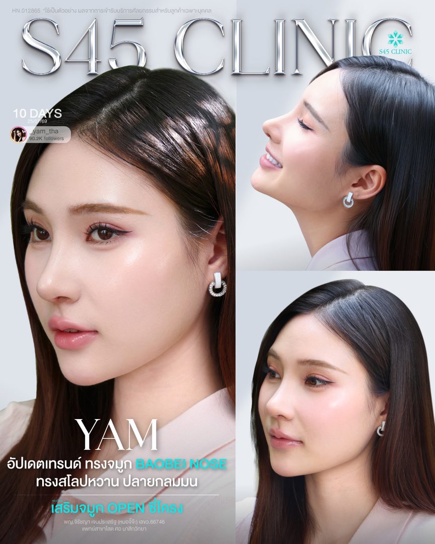 แยม หมอจิ๊จ๊ะ Open3ช่อง
