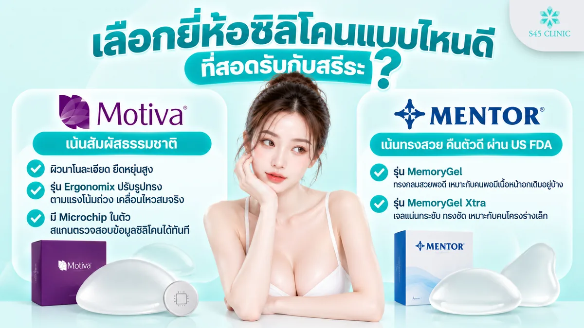 เสริมหน้าอก ดีไหม เลือกยี่ห้อซิลิโคนแบบไหนดีที่สอดรับกับสรีระ