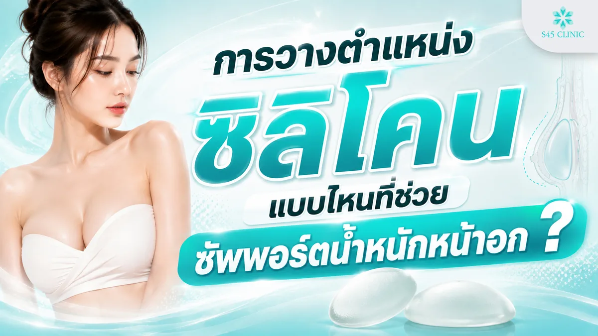 การวางตำแหน่งซิลิโคนแบบไหนที่ช่วยซัพพอร์ตน้ำหนักหน้าอก ใต้ชั้นกล้ามเนื้อและ Dual Plane
