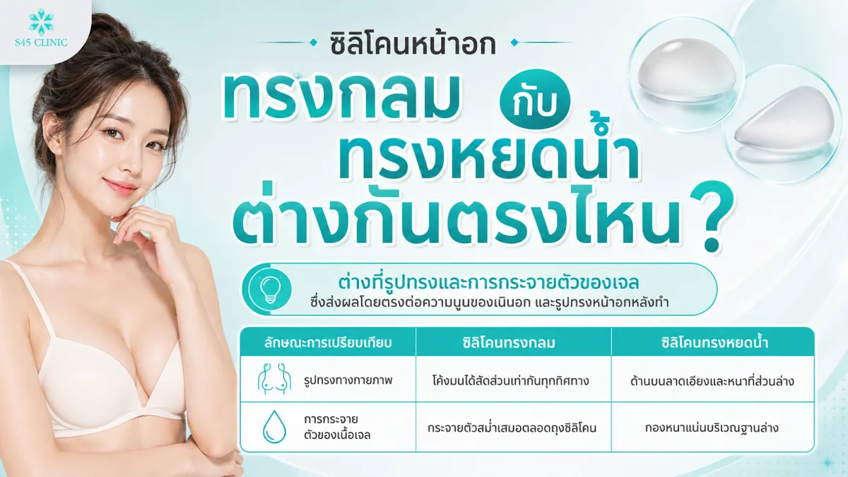 ซิลิโคนหน้าอกทรงกลมกับทรงหยดน้ำต่างกันที่รูปทรงและการกระจายตัวของเจล