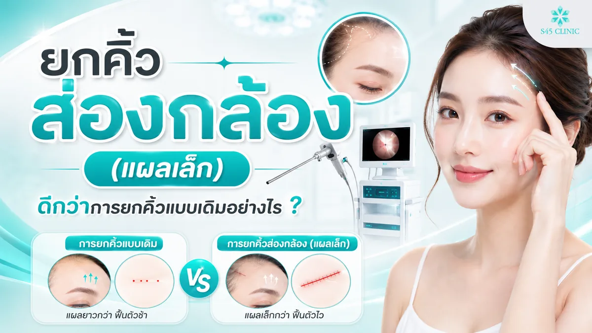 How a small-incision endoscopic brow lift differs from a traditional brow lift