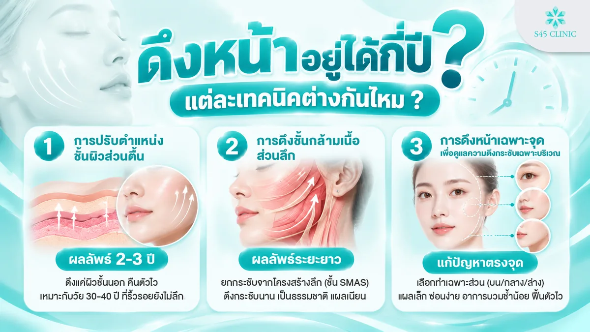 ดึงหน้าอยู่ได้กี่ปี เปรียบเทียบเทคนิคการผ่าตัดดึงหน้าแต่ละระดับชั้นผิว