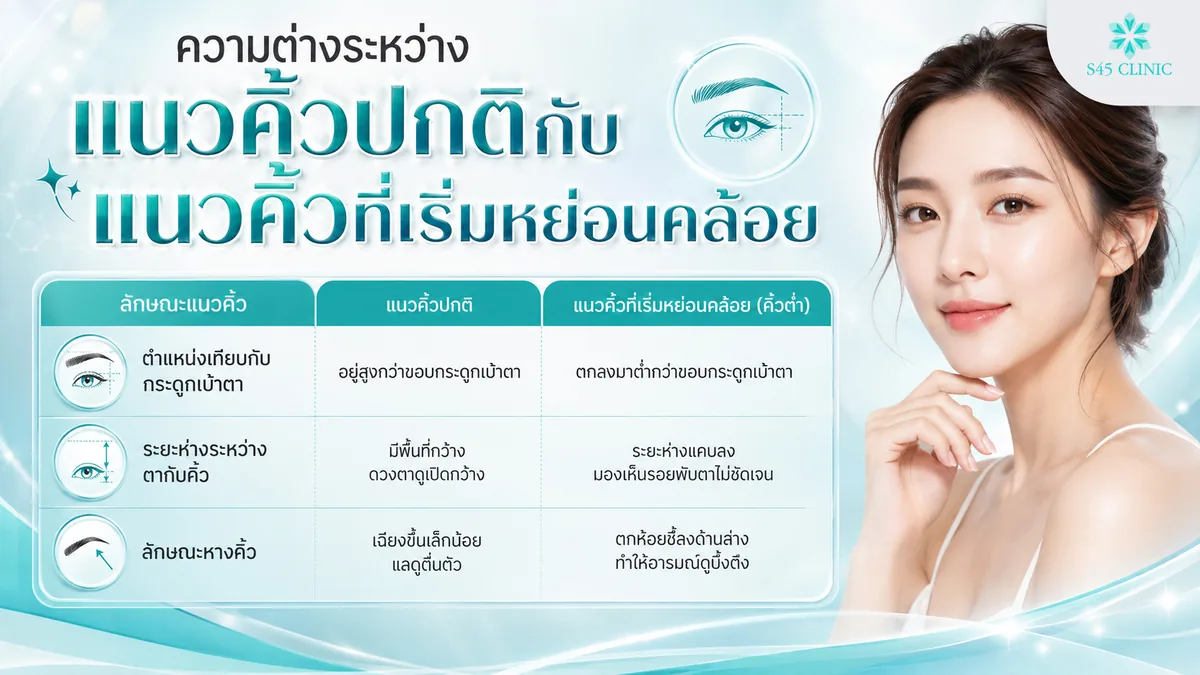 ความต่างระหว่างแนวคิ้วปกติกับแนวคิ้วที่เริ่มหย่อนคล้อย