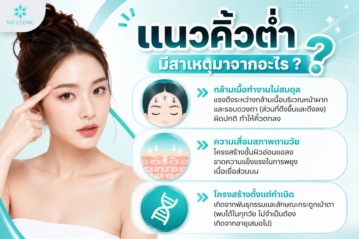 แนวคิ้วต่ำ มีสาเหตุมาจากอะไร