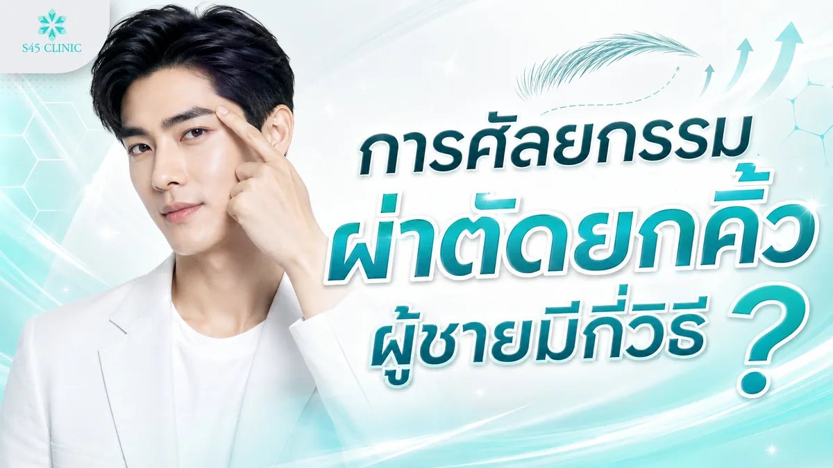 การศัลยกรรมผ่าตัดยกคิ้วผู้ชายมีกี่วิธี ส่องกล้อง Sub Brow Lift Direct Brow Lift