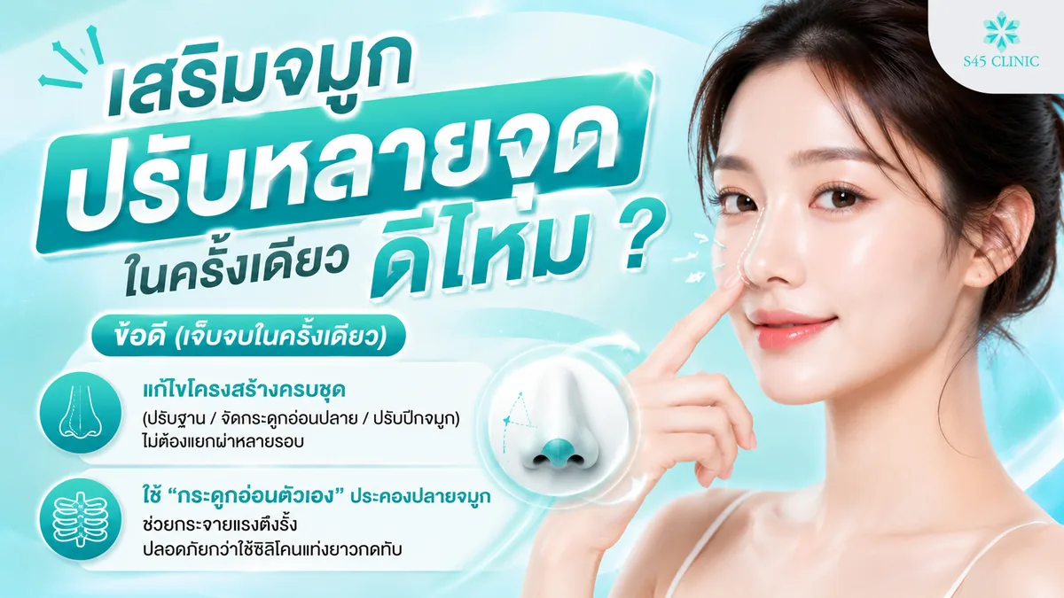 ข้อดีของการเสริมจมูกปรับหลายจุดในครั้งเดียว แก้ไขโครงสร้างครบชุดและใช้กระดูกอ่อนตัวเองประคองปลายจมูก