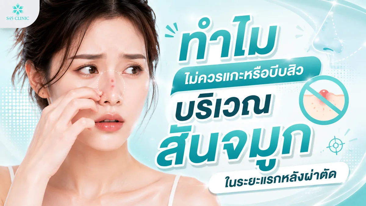 ทำไมไม่ควรแกะหรือบีบสิวบริเวณสันจมูกในระยะแรกหลังผ่าตัด