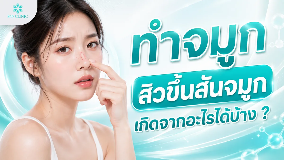 ทำจมูก สิวขึ้นสันจมูก เกิดจากอะไรได้บ้าง สาเหตุจากเฝือกจมูกและการทำความสะอาดผิว