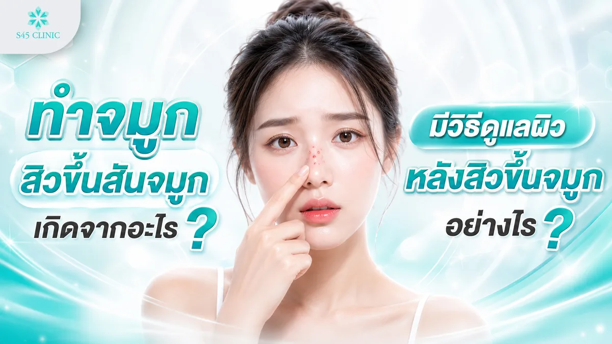 ทำจมูก สิวขึ้นสันจมูก เกิดจากอะไร มีวิธีดูแลผิวหลังสิวขึ้นจมูกอย่างไร