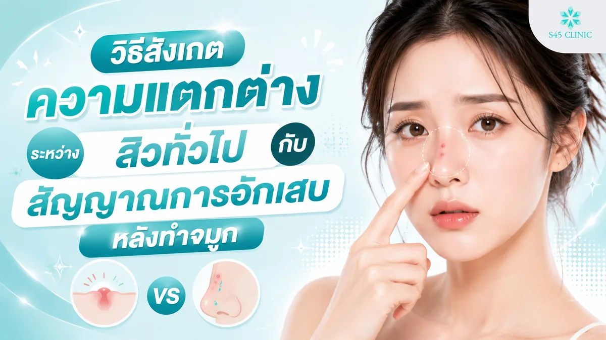 วิธีสังเกตความแตกต่างระหว่างสิวทั่วไปกับสัญญาณการอักเสบติดเชื้อหลังทำจมูก