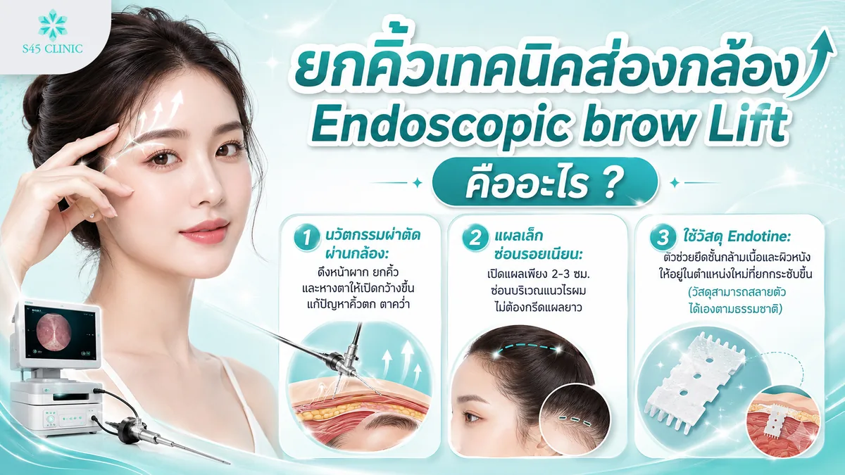 ยกคิ้วเทคนิคส่องกล้อง Endoscopic brow Lift คืออะไร