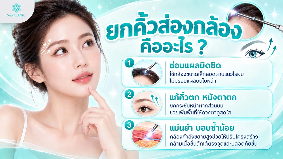 ยกคิ้วส่องกล้องคืออะไร ซ่อนแผลในแนวไรผม แก้คิ้วตกและหนังตาตก