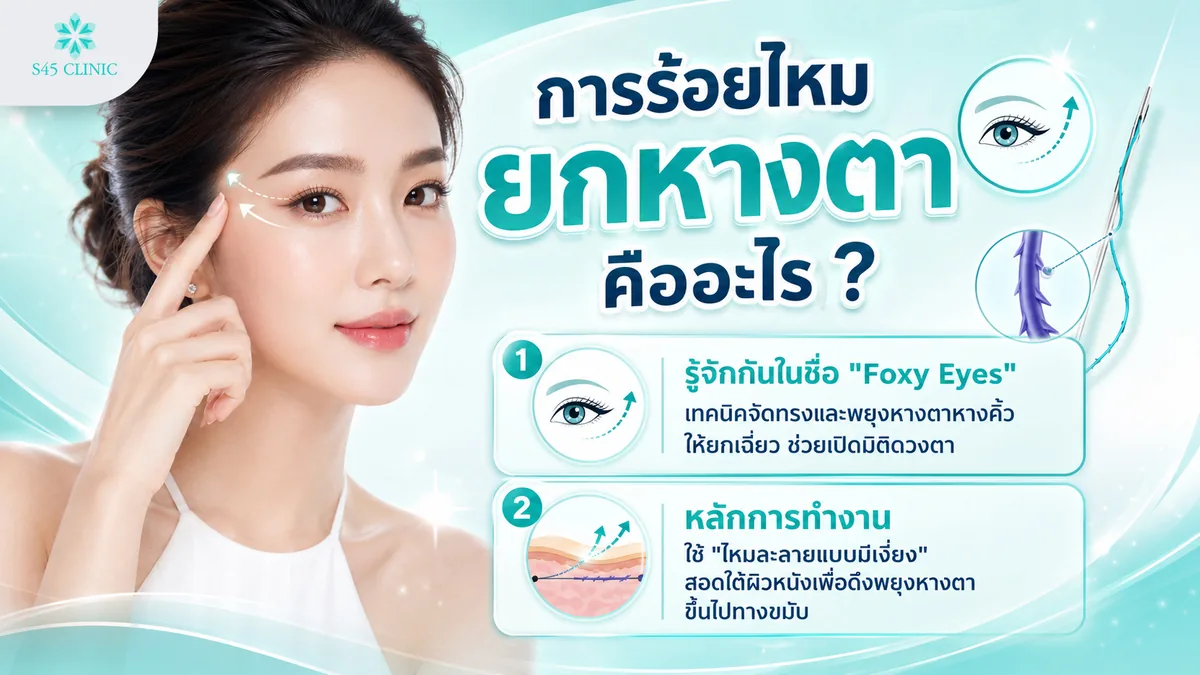 การร้อยไหมยกหางตา คืออะไร รู้จักกันในชื่อ Foxy Eyes